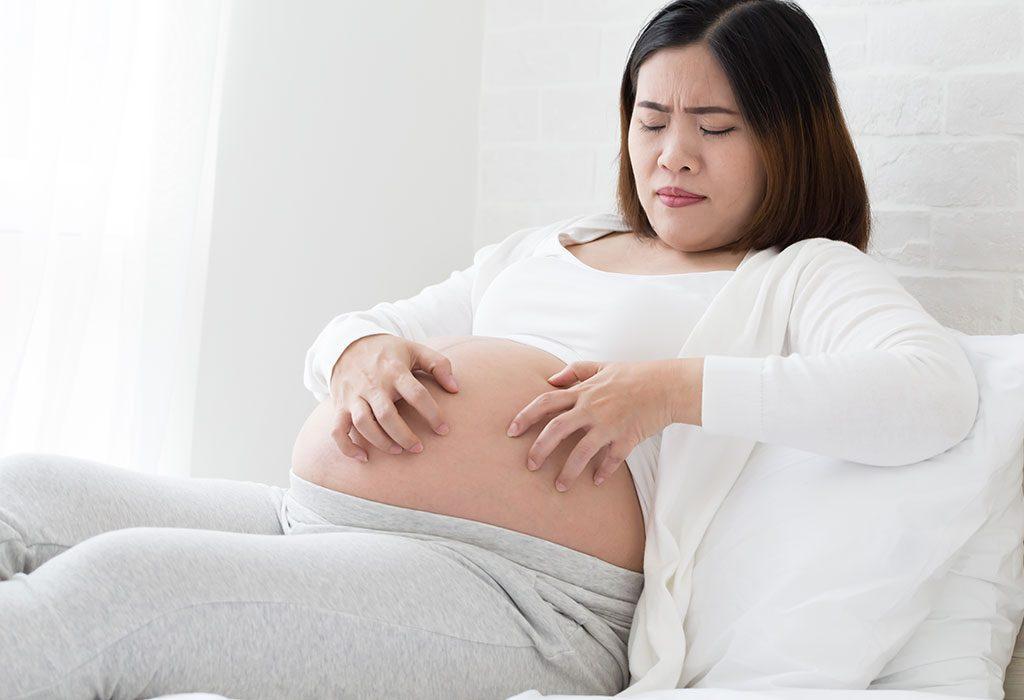 زونا در بارداری؛ علت، علائم، راه های پیشگیری و درمان